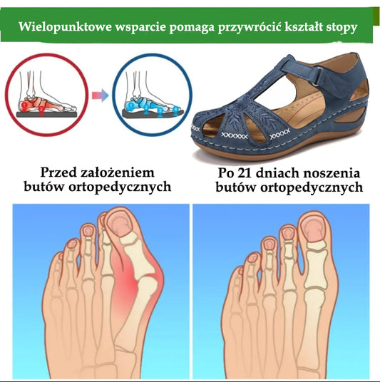 (🔥Specjalna oferta letnia — 50% zniżki przez ograniczony czas) Klasyczne letnie damskie sandały ortopedyczne, łączące wsparcie i oddychalność✅ Zmniejszają nacisk podczas chodzenia, dzięki czemu jest ono łatwiejsze i wygodniejsze.