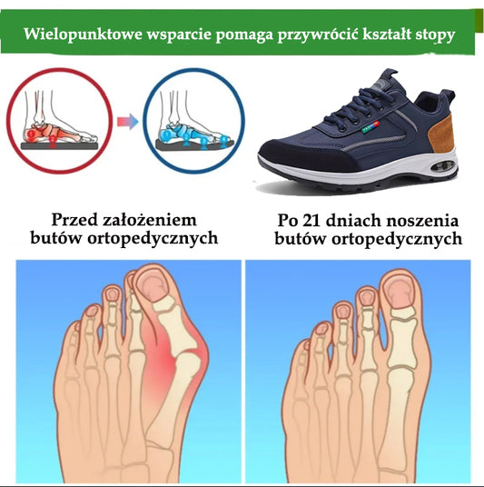 🔥 50% zniżki | Najwygodniejsze i najpopularniejsze w Polsce buty ortopedyczne | Zapewniają wsparcie łuku stopy, łagodzą ból i ułatwiają chodzenie | Odpowiednie zarówno dla mężczyzn, jak i kobiet.