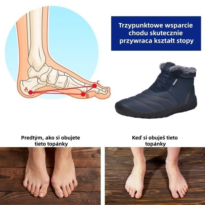 (🔥50% zniżki dzisiaj - ⏰Nie przegap!) - Miękkie i wygodne śniegowce Flemat® (z podparciem łuku stopy - dzięki czemu chodzenie jest łatwiejsze)