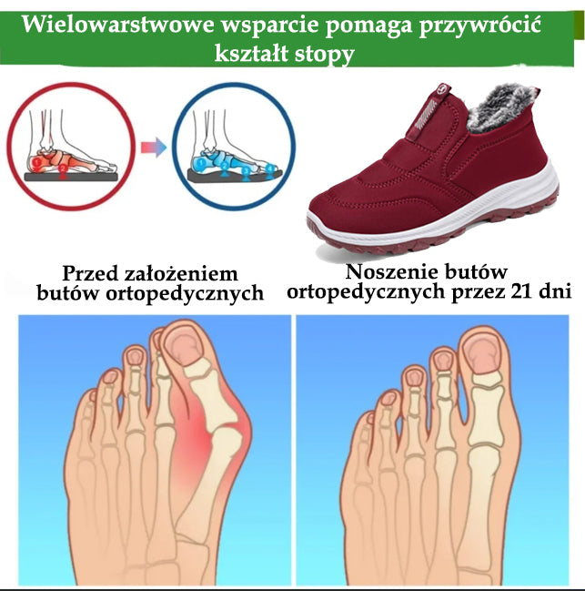 (🔥DZIŚ 50% ZNIŻKI - NIE PRZEGAP) ⏰ - Miękkie i wygodne zimowe, włoskie, luksusowe, ortopedyczne buty zamszowe (wsparcie - ulga w bólu stóp)