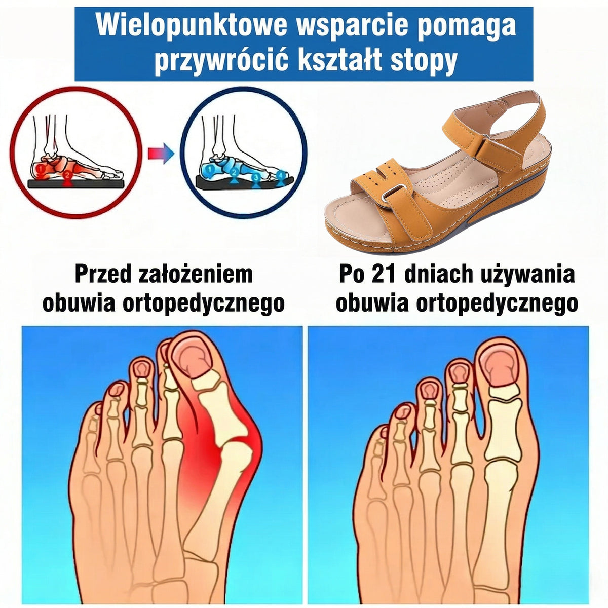 ⏰Ograniczona czasowo promocja z obniżką o połowę🔥Letnie sandały ortopedyczne ✅Wsparcie łuku stopy ✅Wygodne i bezbolesne chodzenie ✅Ergonomiczna konstrukcja