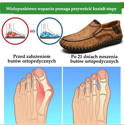 🔥Męskie buty ortopedyczne wykonane z australijskiej skóry cielęcej👞Szyte ręcznie✅Wygodne chodzenie, łagodzenie bólu✅Wodoodporne i antypoślizgowe✅