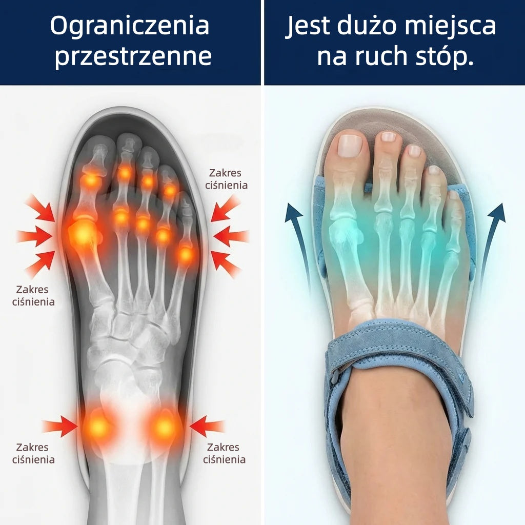 🔥 Ograniczona czasowo zniżka 50%! Letnie sandały ortopedyczne – ergonomiczne, wygodne i oddychające, które łagodzą ból. ✅