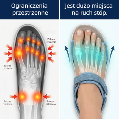 🔥 Ograniczona czasowo zniżka 50%! Letnie sandały ortopedyczne – ergonomiczne, wygodne i oddychające, które łagodzą ból. ✅