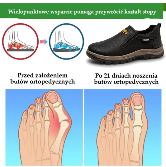 🔥 50% zniżki | buty ortopedyczne flemat® | Zapewniają wsparcie łuku stopy, łagodzą ból i ułatwiają chodzenie