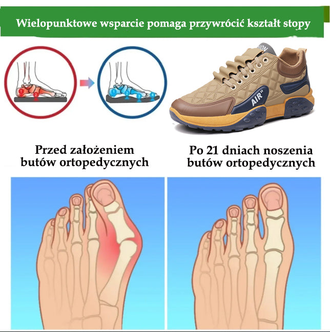 🔥 50% zniżki | Buty ortopedyczne Flemat® | Zapewniają wsparcie łuku stopy, łagodzą ból i ułatwiają chodzenie | Odpowiednie zarówno dla mężczyzn, jak i kobiet.