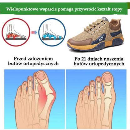 🔥 50% zniżki | Buty ortopedyczne Flemat® | Zapewniają wsparcie łuku stopy, łagodzą ból i ułatwiają chodzenie | Odpowiednie zarówno dla mężczyzn, jak i kobiet.