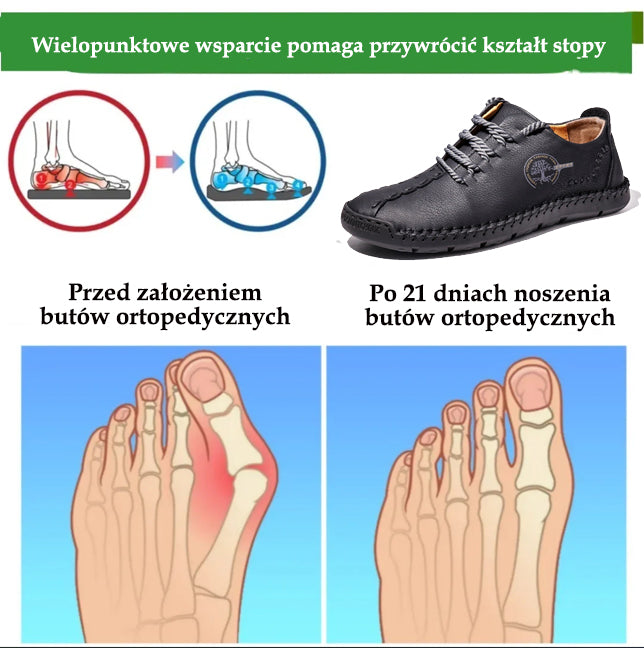 🔥 50% zniżki | buty ortopedyczne flemat® | Zapewniają wsparcie łuku stopy, łagodzą ból i ułatwiają chodzenie