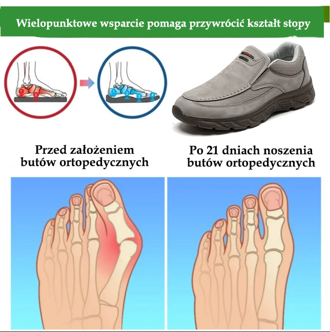 🔥 50% zniżki | buty ortopedyczne flemat® | Zapewniają wsparcie łuku stopy, łagodzą ból i ułatwiają chodzenie