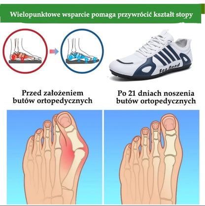 🔥 50% zniżki | Buty ortopedyczne Flemat® | Zapewniają wsparcie łuku stopy, łagodzą ból i ułatwiają chodzenie | Odpowiednie zarówno dla mężczyzn, jak i kobiet.