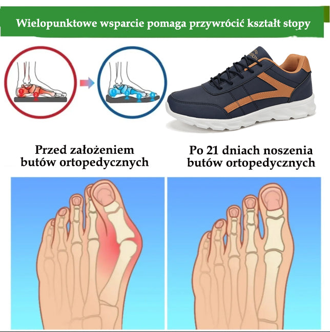 🔥 50% zniżki | buty ortopedyczne flemat® | Zapewniają wsparcie łuku stopy, łagodzą ból i ułatwiają chodzenie
