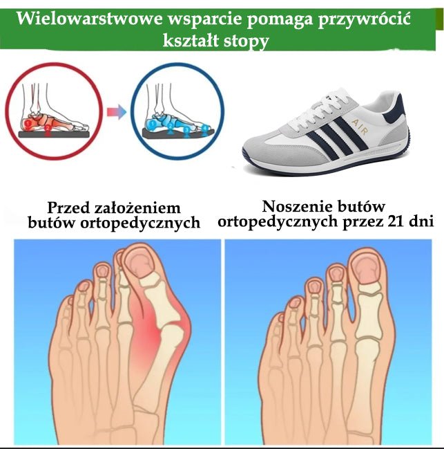 🔥 50% zniżki | Buty ortopedyczne Flemat® | Zapewniają wsparcie łuku stopy, łagodzą ból i ułatwiają chodzenie | Odpowiednie zarówno dla mężczyzn, jak i kobiet.